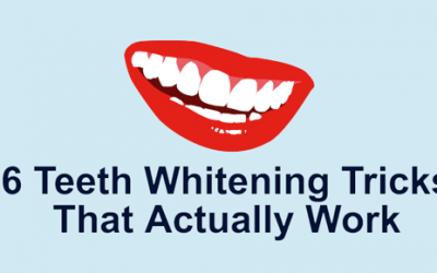 6 Teeth Whitening Tricks That Actually Work