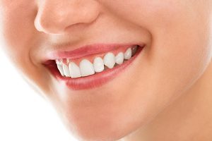 Gum Problems | Dentist Cardiff