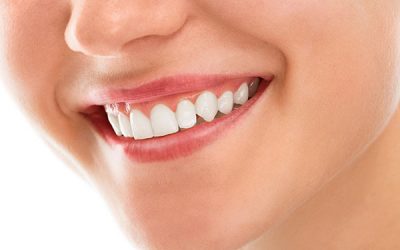 Gum Problems – How to Prevent Them?