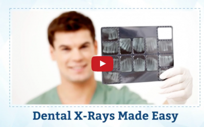 Dental X-rays Made Easy: Reliable, Fast and Efficient