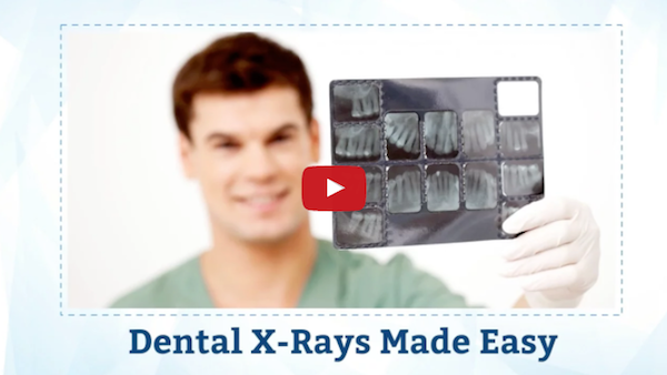 Dental X-rays Made Easy: Reliable, Fast and Efficient