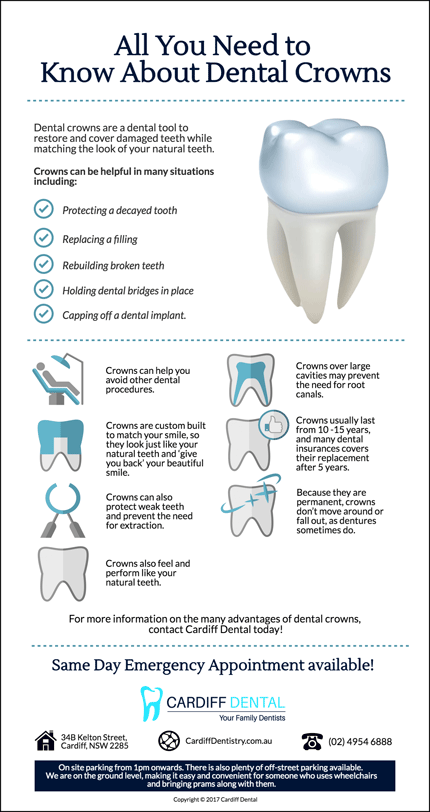 Dental-Crowns-What-You-Should-Know