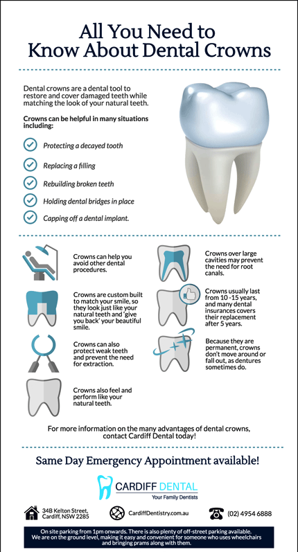 Dental-Crowns-What-You-Should-Know