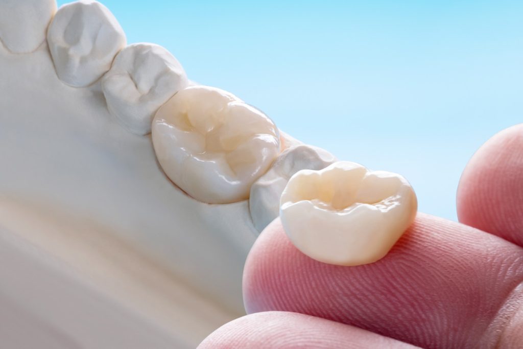 dental crowns what you should know