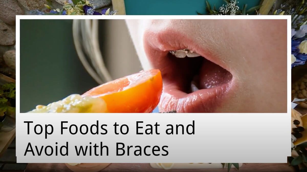 Top Foods to Eat and Avoid with Braces from Cardiff Dental Cardiff Dental