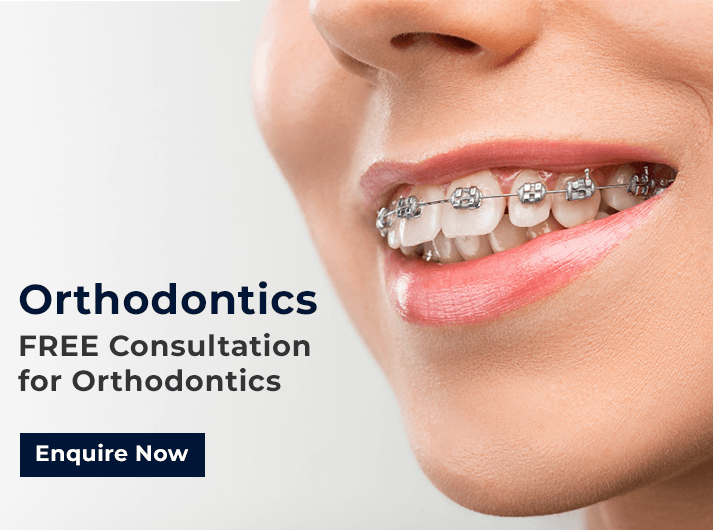 orthodontics promo banner cardiff