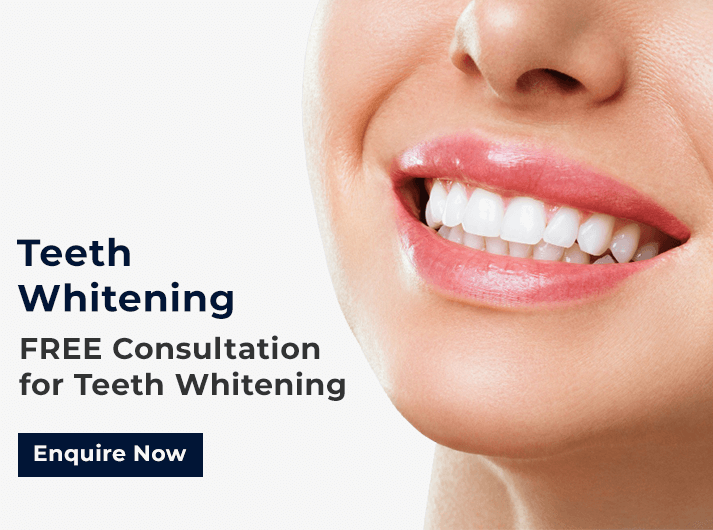 teeth whitening promo banner cardiff