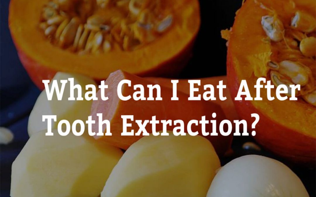 What Can I Eat After Tooth Extraction? 7 Tips from Cardiff Dental