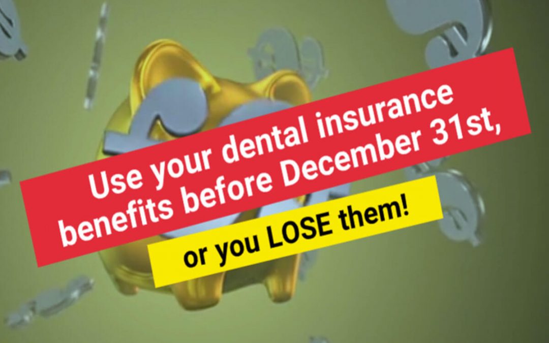 Dental Insurance Benefits: Use it or Lose it! | Cardiff Dental