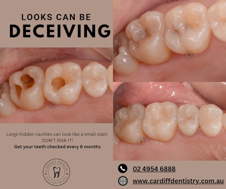 white fillings banner dentist cardiff