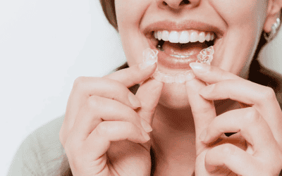 Invisalign in Newcastle: Clear Aligners Explained
